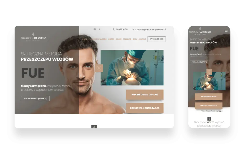 Strona internetowa Sharley Hair Clinic z Warszawy oferująca przeszczepy włosów i leczenie łysienia