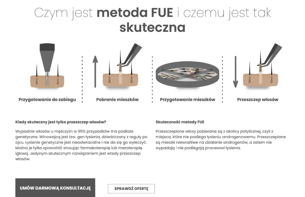 Strona internetowa Sharley Hair Clinic z ofertą przeszczepów włosów i leczenia łysienia w Warszawie